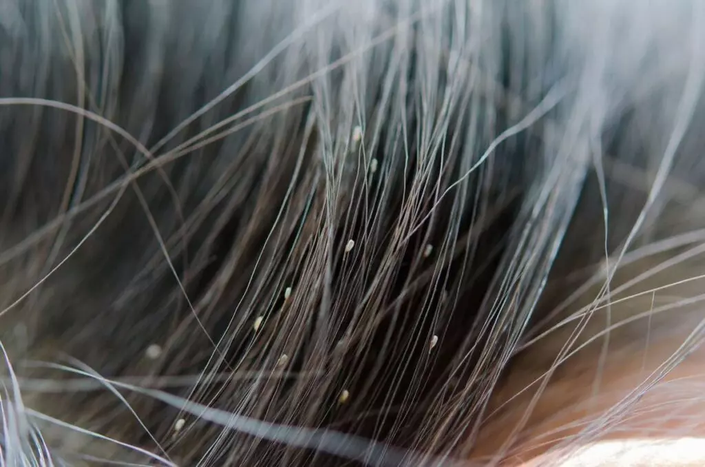 Zvidky Berutsya Voshi V Dorosloyi Lyudyny05 Treba Solutions 1024x678 1