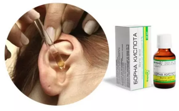 Bornyy Spirt V Uho Mozhno Li Kapat Bornyy Spirt Pri Otite V Ushi 2