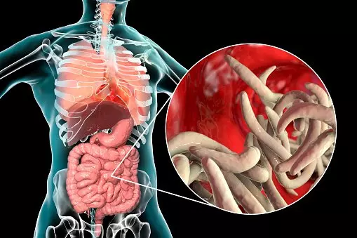Parasitic Worms In Human Small Intestine 1 63ce8561d1bd1